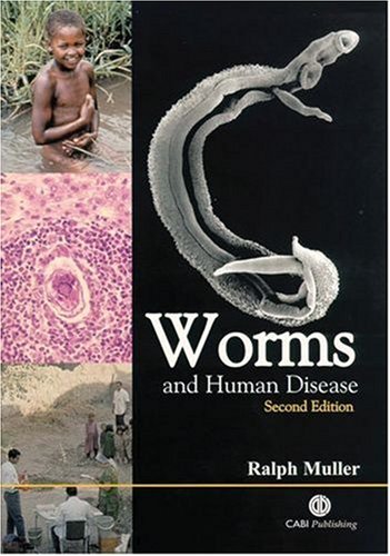 Worms And Human Disease Second R Muller