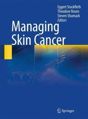 Managing Skin Cancer 1st Edition S Astner M Ulrich Auth Eggert Stockfleth