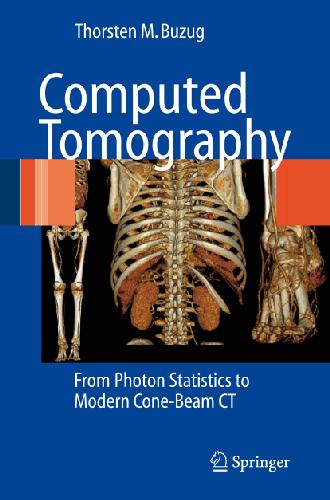Computer Tomography From Photon Statistics To Modern Conebeam Ct Thorstenmbuzug