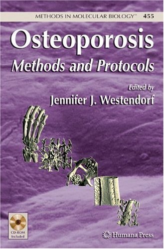 Osteoporosis Methods And Protocols 1st Edition Thomas A Owen