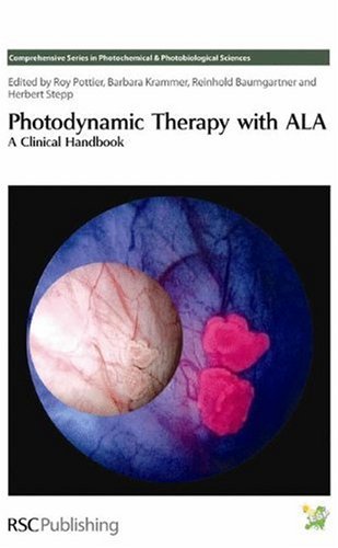 Photodynamic Therapy With Ala A Clinical Handbook 1st Edition Roy Pottier