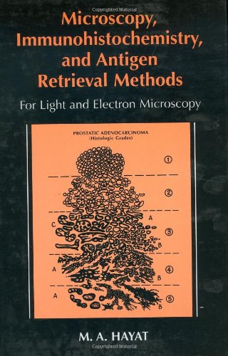 Microscopy Immunohistochemistry And Antigen Retrieval Methods For Light And Electron Microscopy Ma Hayat