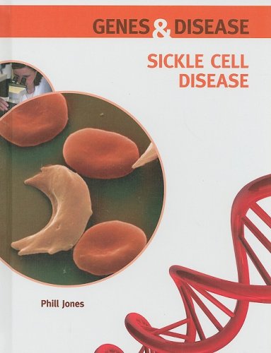 Sickle Cell Disease Genes And Disease 1st Edition Phill Jones