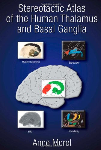 Stereotactic Atlas Of The Human Thalamus And Basal Ganglia Morel Anne