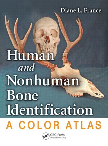 Human And Nonhuman Bone Identification A Color Atlas 1st Edition Diane L France