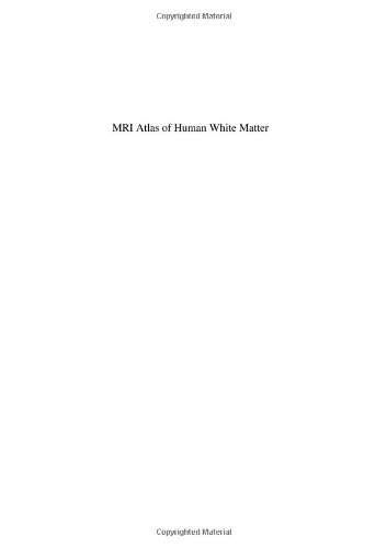 Mri Atlas Of Human White Matter 1st Ed S Mori S Wakana Pcm Van Zijl