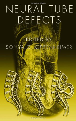 Neural Tube Defects 1st Edition Sonya G Oppenheimer