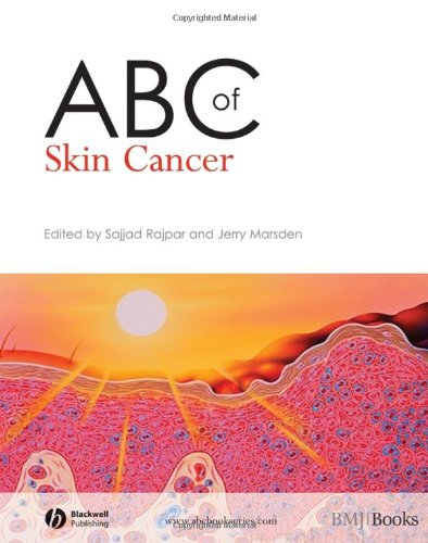 Abc Of Skin Cancer Abc Series 1st Edition Sajjad Rajpar Jerry Marsden