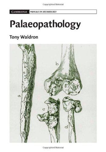 Palaeopathology 1st Edition Tony Waldron