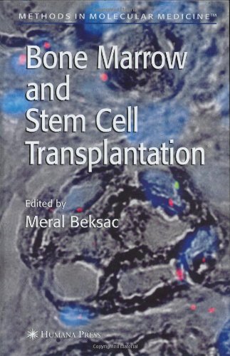 Bone Marrow And Stem Cell Transplantation 1st Edition Teresa V Bowman