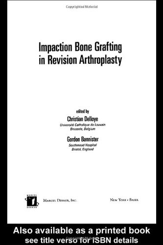 Impaction Bone Grafting In Revision Arthroplasty 1st Edition Christian Delloye