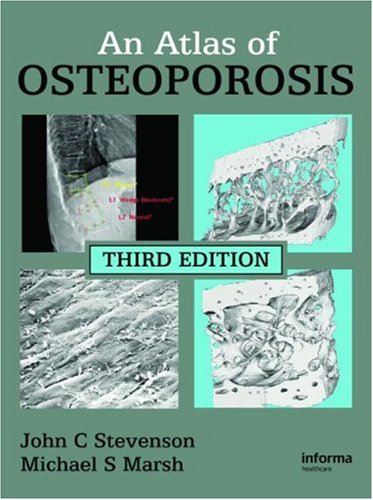 An Atlas Of Osteoporosis Third Edition 3rd Edition John C Stevenson