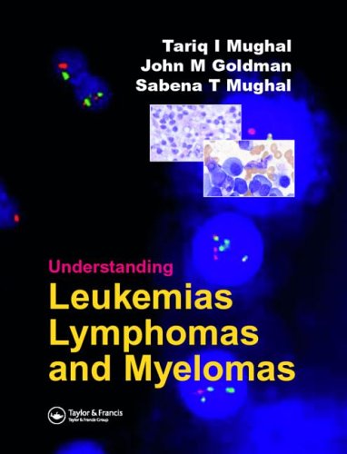 Understanding Leukemias Lymphomas And Myelomas Second Edition 1st Edition Tariq Mughal