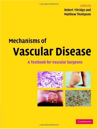 Mechanisms Of Vascular Disease A Textbook For Vascular Surgeons 1st Edition Robert Fitridge