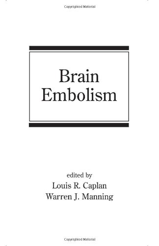 Brain Embolism 1st Edition R Caplan Louis Warren J Manning