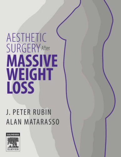 Aesthetic Surgery After Massive Weight Loss 1st J Peter Rubin
