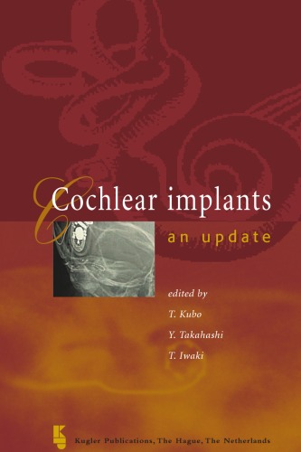 Cochlear Implantsan Update T Kubo Y Takahashi T Iwaki