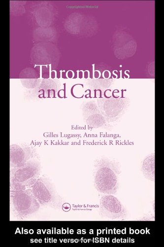 Thrombosis And Cancer 1st Edition Gilles Lugassy Anna Falanga