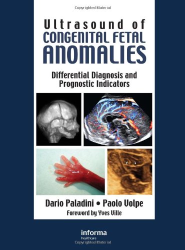 Ultrasound Of Congenital Fetal Anomalies 1st Edition Dario Paladini