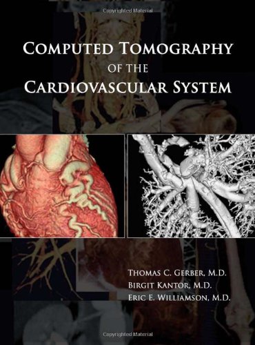 Computed Tomography Of The Cardiovascular System 1st Edition Thomas C Gerber