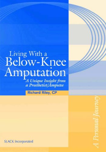 Living With A Belowknee Amputation A Unique Insight From A Prosthetistamputee 1st Richard Lee Riley Cp Bs