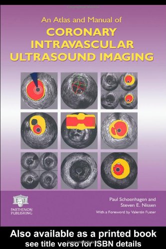 An Atlas And Manual Of Coronary Intravascular Ultrasound Imaging 1st Edition Paul Schoenhagen
