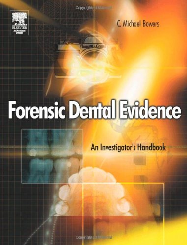 Forensic Dental Evidence An Investigators Handbook 1st Edition C Michael Bowers Dds Jd
