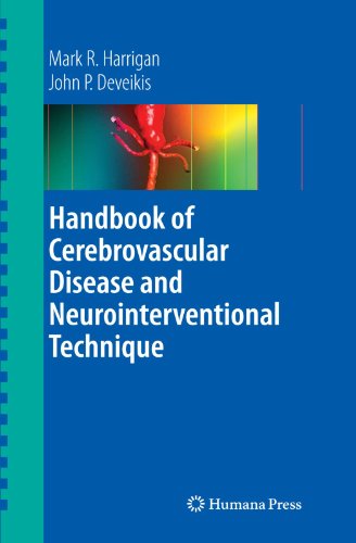 Handbook Of Cerebrovascular Disease And Neurointerventional Technique 1st Edition Mark R Harrigan
