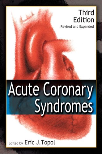 Acute Coronary Syndromes 3rd Edition Eric J Topol Eric Topol