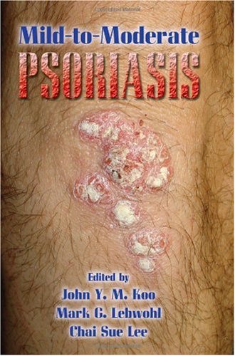 Mildtomoderate Psoriasis 1st Edition Ym Koo John Mark G Lebwohl