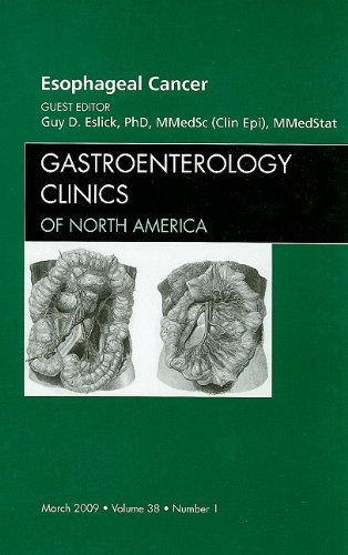 Esophageal Cancer An Issue Of Gastroenterology Clinics 1st Edition Guy D Eslick Phd