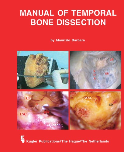 Manual Of Temporal Bone Dissection M Barbara