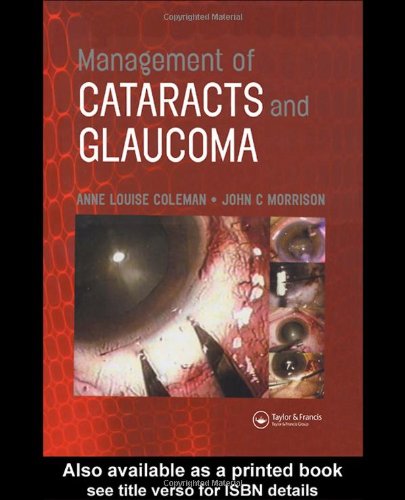 Management Of Cataracts And Glaucoma 1st Edition Anne Louise Coleman