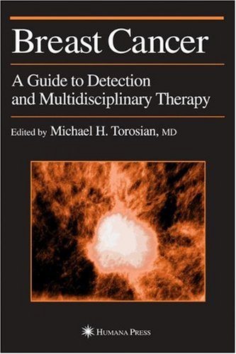 Breast Cancer A Guide To Detection And Multidisciplinary Therapy 1st Michael H Torosian