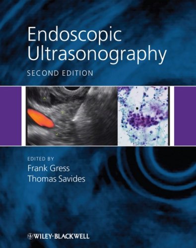 Endoscopic Ultrasonography 2nd Edition Frank G Gress Thomas J Savides