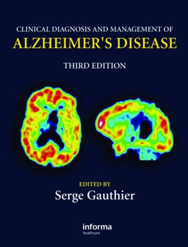 Clinical Diagnosis And Management Of Alzheimers Disease 3rd Edition Gauthier Serge