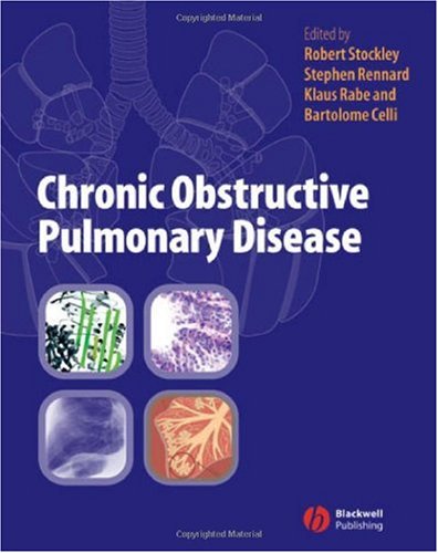 Chronic Obstructive Pulmonary Disease 1st Edition Steve Rennard