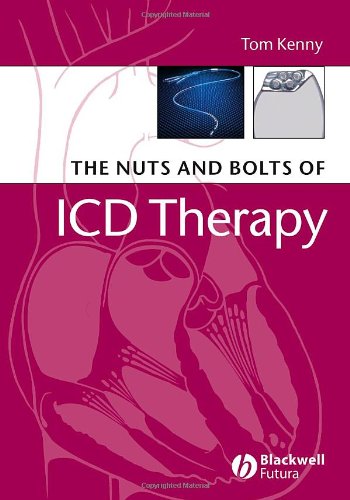 The Nuts And Bolts Of Icd Therapy 1st Edition Tom Kenny