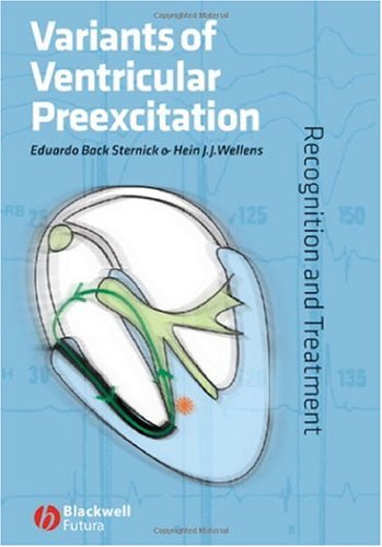 Variants Of Ventricular Preexcitation Recognition And Treatment 1st Edition Eduardo Back Sternick