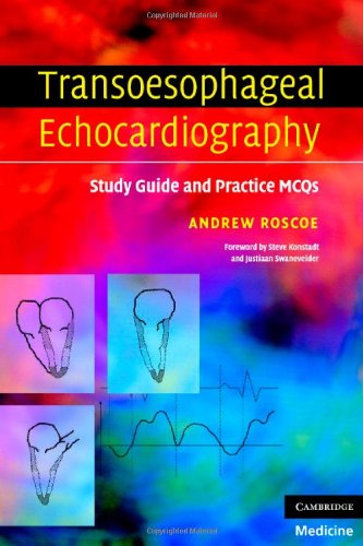 Transoesophageal Echocardiography Study Guide And Practice Mcqs 1st Edition Andrew Roscoe