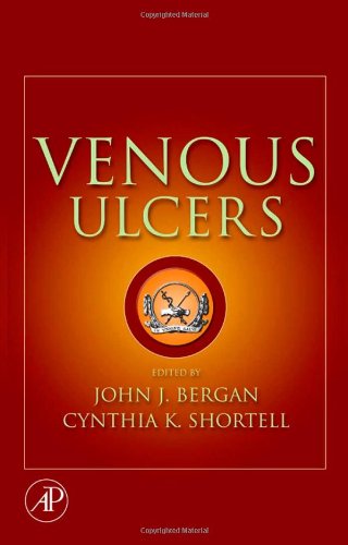 Venous Ulcers 1st Edition John J Bergan Cynthia Shortell