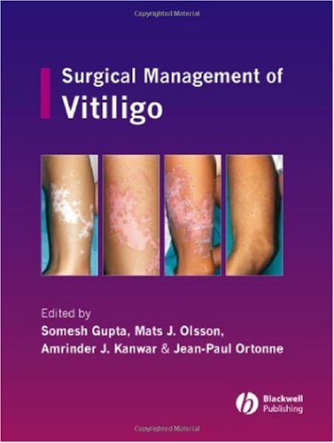 Surgical Management Of Vitiligo 1st Edition Somesh Gupta Mats J Olsson