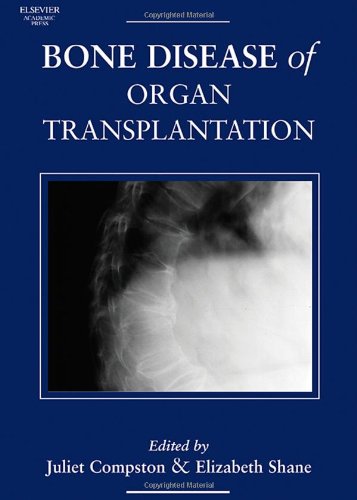 Bone Disease Of Organ Transplantation 1st Edition Juliet Compston
