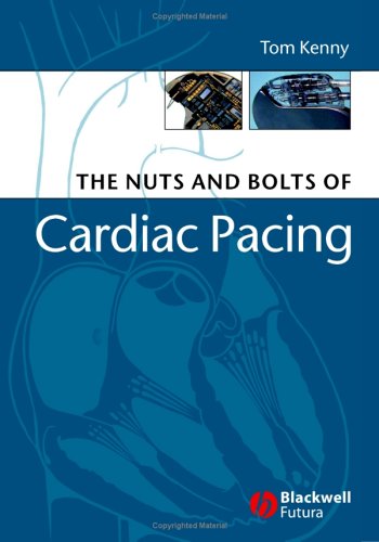 Nuts And Bolts Of Cardiac Pacing 2nd Edition Tom Kenny