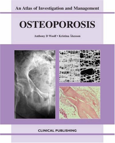 Osteoporosis An Atlas Of Investigation And Diagnosis 1st Edition Anthony D Woolf