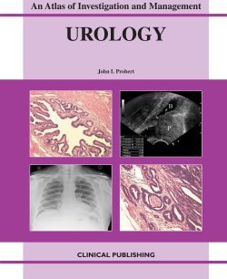Urology An Atlas Of Investigation And Diagnosis 1st Edition John L Probert