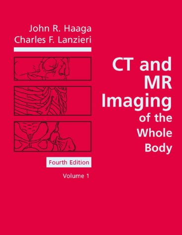 Ct And Mr Imaging Of The Whole Body 4th Edition John R Haaga