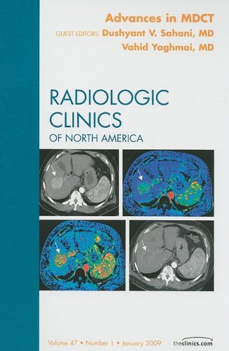 Advances In Mdct An Issue Of Radiologic Clinics 1st Edition Vahid Yaghmai Md