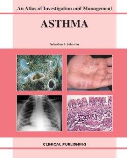Asthma An Atlas Of Investigation And Diagnosis 1st Edition Sebastian L Johnston