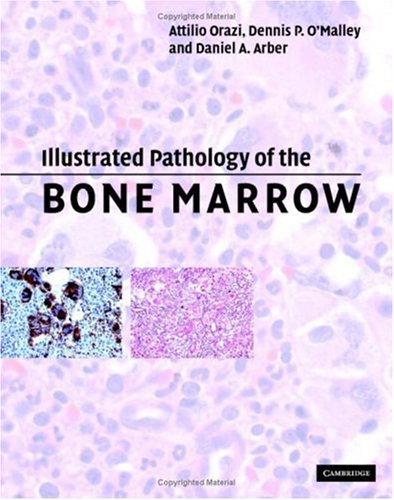 Illustrated Pathology Of The Bone Marrow 1st Edition Attilio Orazi